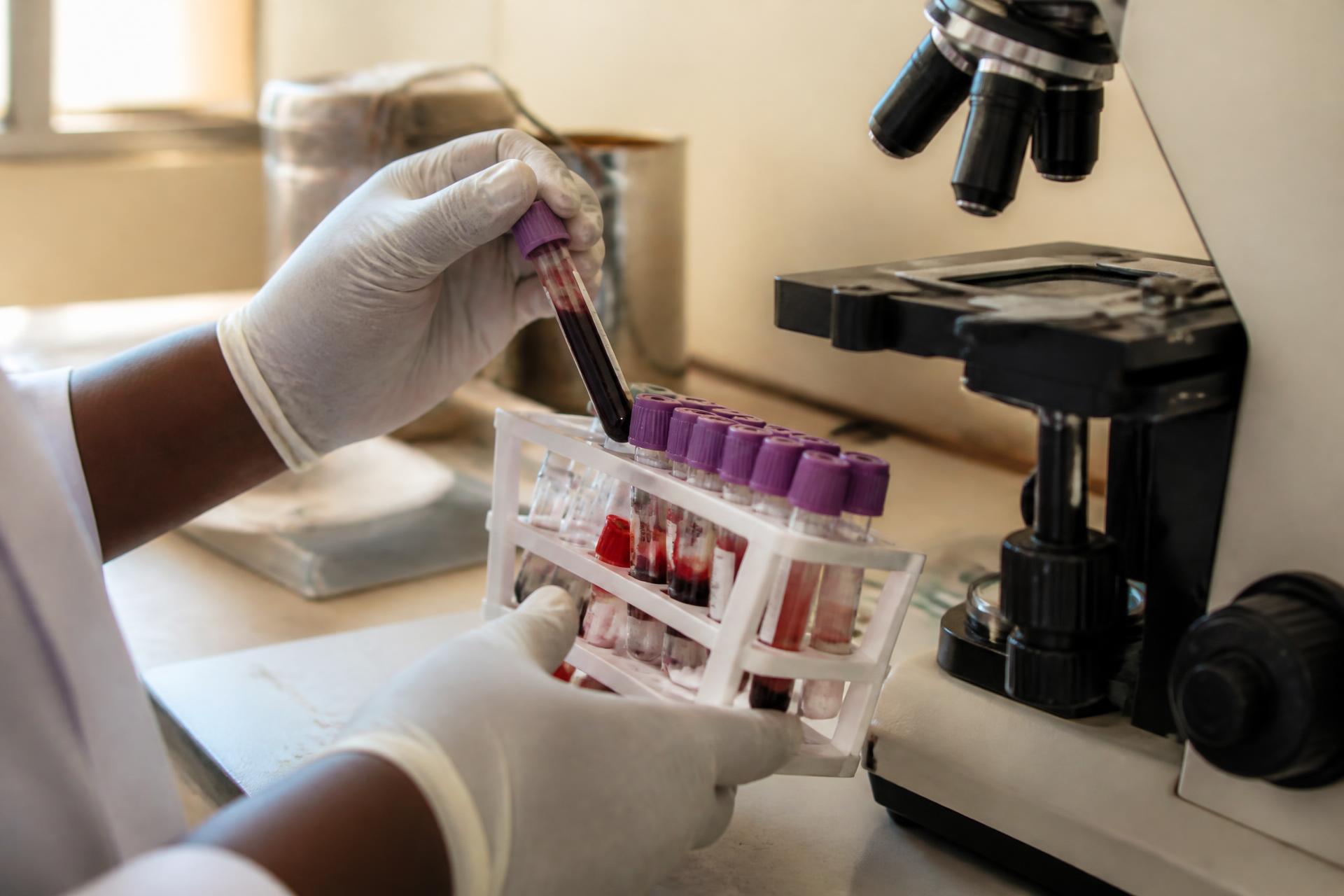 A laboratory technician preparing blood sample tubes beside a microscope
